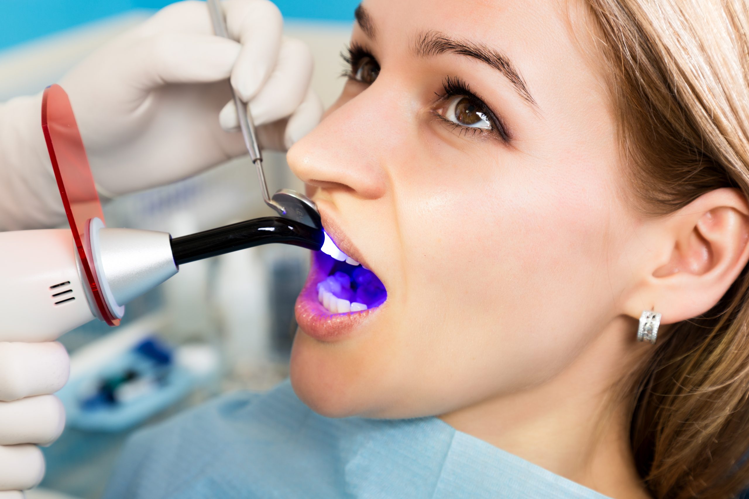 Meridian Cosmetic Tooth Bonding