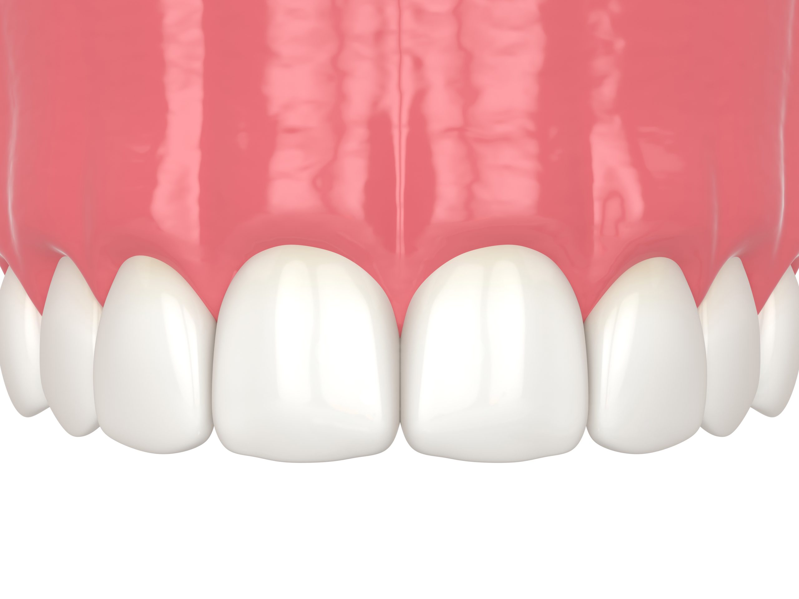 Benefits of cosmetic bonding for your smile
