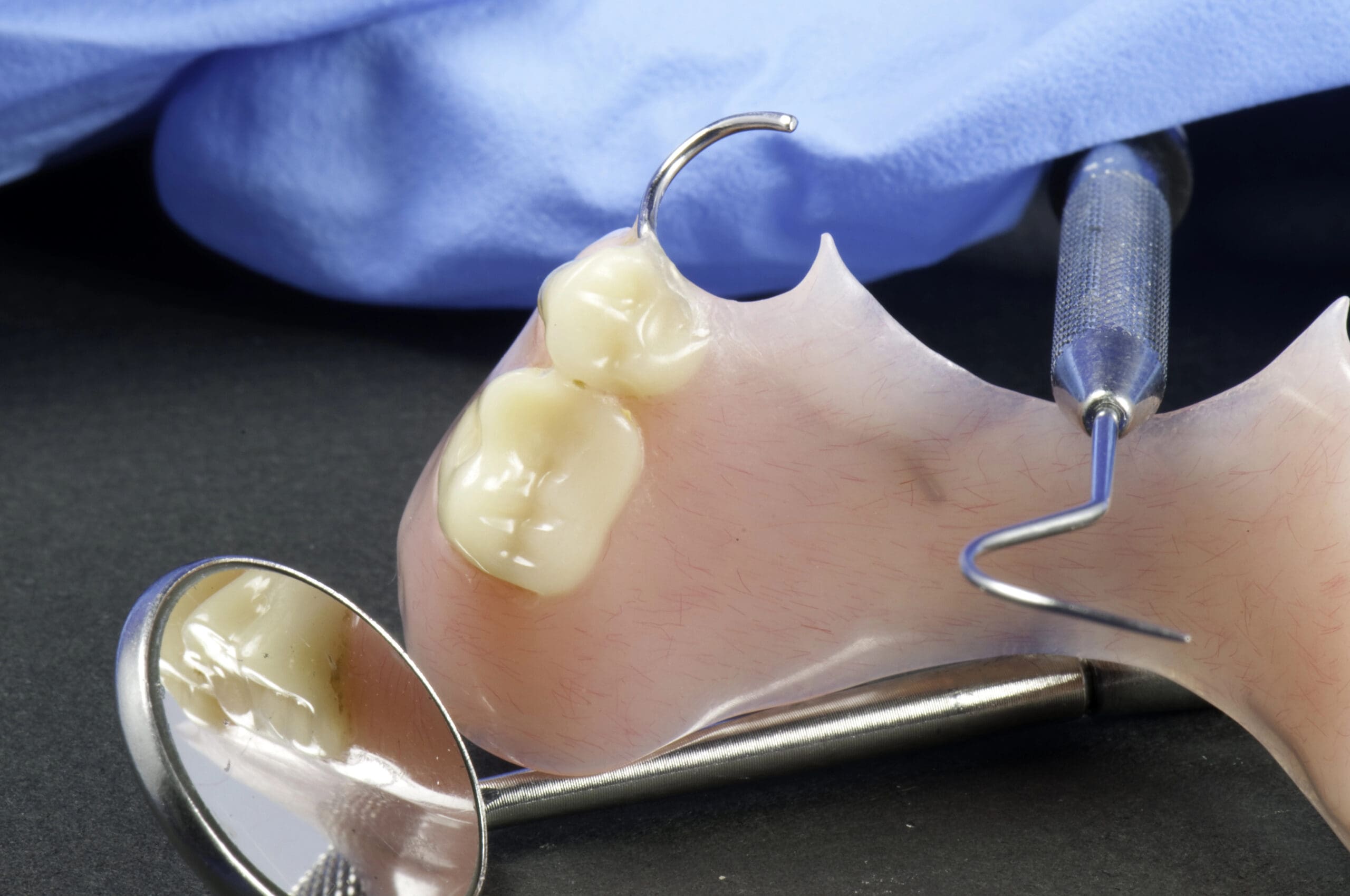 Partial Dental Bridges Pros and Cons: Making an Informed Choice